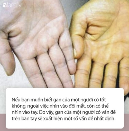 Nhìn qua những điểm trên bàn tay để biết Gan tốt hay không